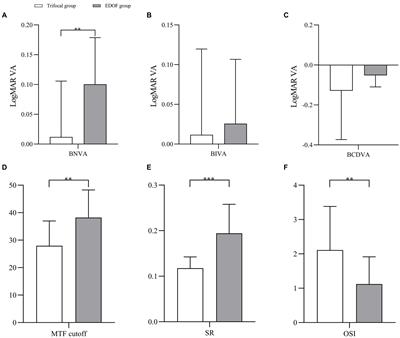 Tolerance to induced astigmatism of patients with trifocal or extended depth of focus intraocular lens implantation